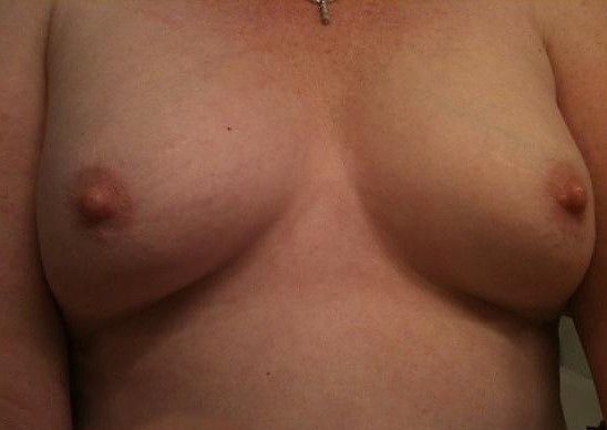 my breast