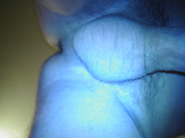 123