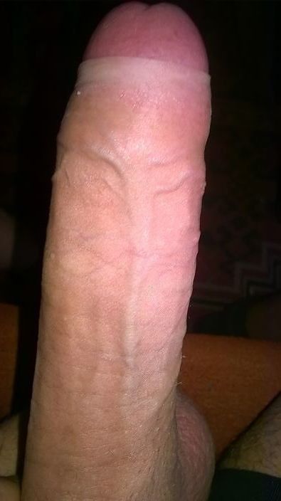 my dick