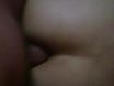 Anal